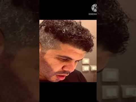 الصور الأولى للمطرب عمر كمال بعد عملية تجميل زراعة الدقن