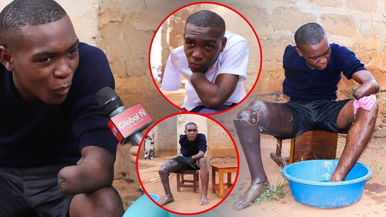 Mwanafunzi Aliyekatwa Mikono, Mguu AFANYA MAAJABU DARASANI