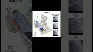 What is fluoroscopy #fluoroscopy #trending #youtubeshorts #science #anatomy #test #lab #notes #mlt