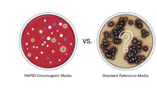 RAPID'Chromogenic Media Solutions