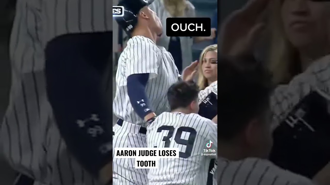 Judge's tooth gets chipped in celebration