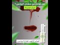 بخاخ علاج البواسير 