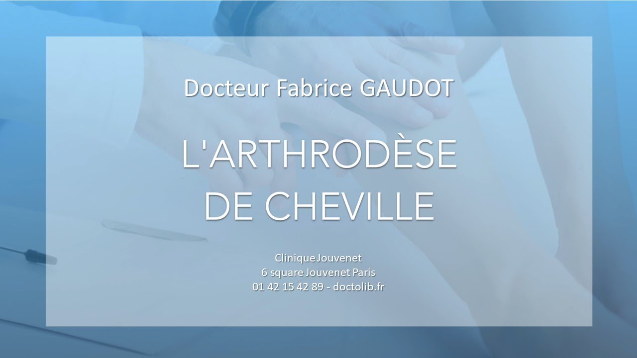 Arthrodèse de cheville. Chirurgie de la cheville. Dr GAUDOT, chirurgien, clinique Jouvenet, Paris.