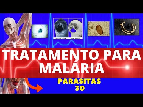 TRATAMENTO PARA MALÁRIA - PARASITOLOGIA | INFECTOLOGIA