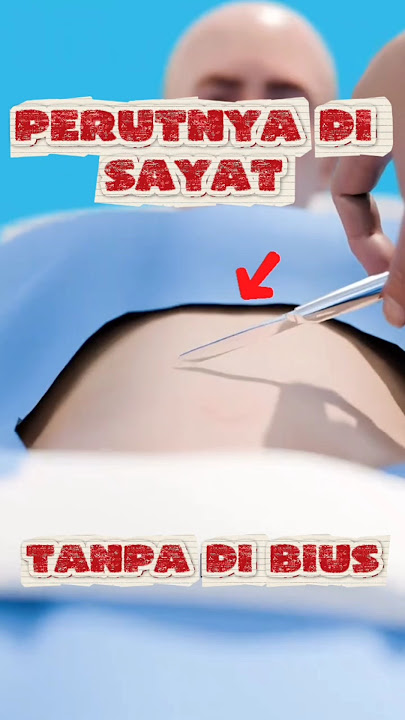 NGERI‼️Perutnya di sayat tanpa di bius⁉️😰😨😱 #viralvideo #funfacts #ytshorts #animation #trending