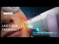 Laser Skin Treatment - LaseMD by Lutronic 2020 (Medical Device 3D Animation)