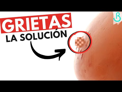 Vídeo: Grietas En Los Pezones Durante La Alimentación: ¿qué Hacer, Cómo Tratar? Ungüentos, Cremas, Prevención