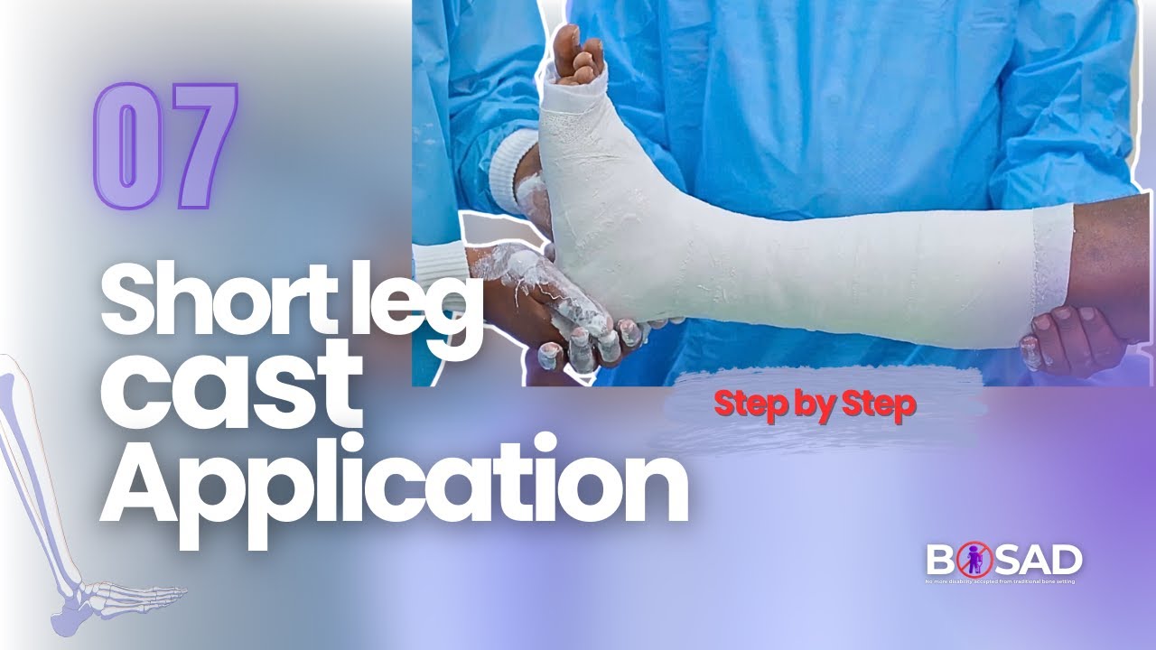 Lesson 07: Short Leg Cast Application| ከጉልበት በታች የሙሉ ጀሶ አሰራር| Step-by ...