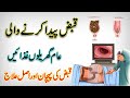 Kitchen Foods That Cause a Constipation / Home Remedy For Constipation / Qabz Ka Desi Ilaj In Urdu