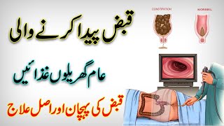 Kitchen Foods That Cause a Constipation / Home Remedy For Constipation / Qabz Ka Desi Ilaj In Urdu