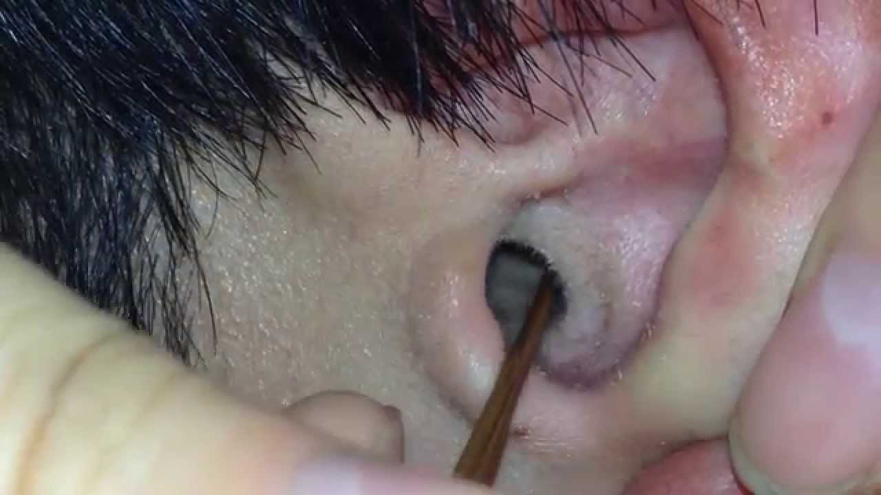 耳かきくらぶ【その13】- Ear cleaning,Ear wax removal How to clean ear wax Part.13 - 귀청소 13 - 귀파기 13 - 掏耳朵