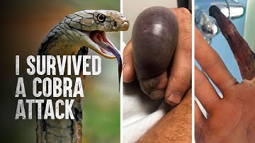 How to Survive a King Cobra Attack