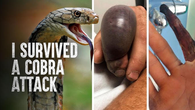 Snake Attacking Man snake-attacking-man