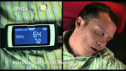 Sleep apnea video