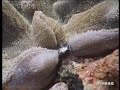 ミクロの毒針