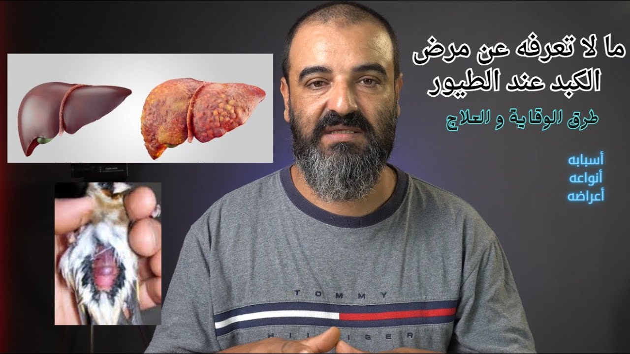 مرض الكبد عند الطيور أنواعه,أسبابه و طرق الوقاية و العلاج