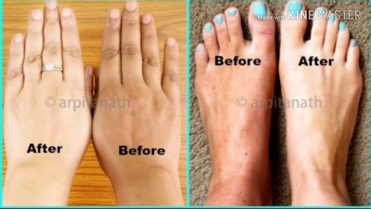 Homemade oil for skin whitening YouTube