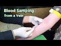 How to take venous blood sample  venipuncture  phlebotomy  vein