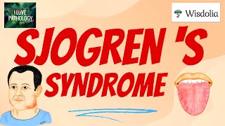 SJOGREN'S SYNDROME | Etiopathogenesis, Morphology, Clinical Features & treatment