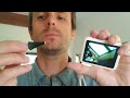 ScopeAround M28 Digital Otoscope Review (Hands-on Testing)