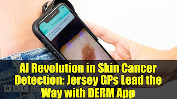 AI Revolution in Skin Cancer Detection: Jersey GPs Lead the Way with DERM App