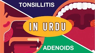 What Is Adenoids And Tonsillitis? Complete Video Adenoids And Tonsillitis Kia Hain? Urduhindi