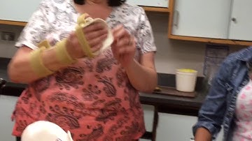 Different types of splints 3rd video