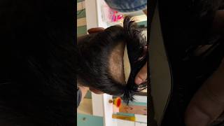 Premium Australian Hair Patch for Men in Delhi | 100% Invisible Frontline Demo 🔥 #shorts #hairpatch