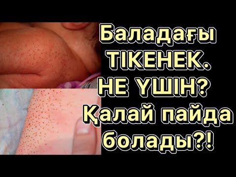 Бейне: Рентгенде тікен пайда бола ма?