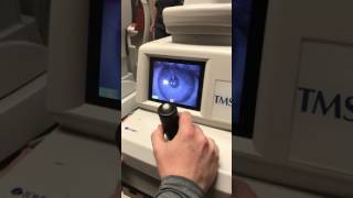 Tomey TMS-4 corneal topography