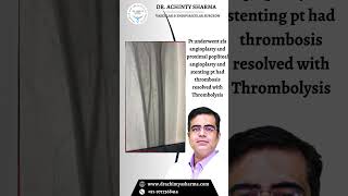 SFA and Proximal Popliteal Angioplasty | DR  Achintya Sharma