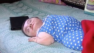 Женщина, которая живет в теле младенца! | Говорить Україна Женщина, которая живет в теле младенца! | Говорить Україна