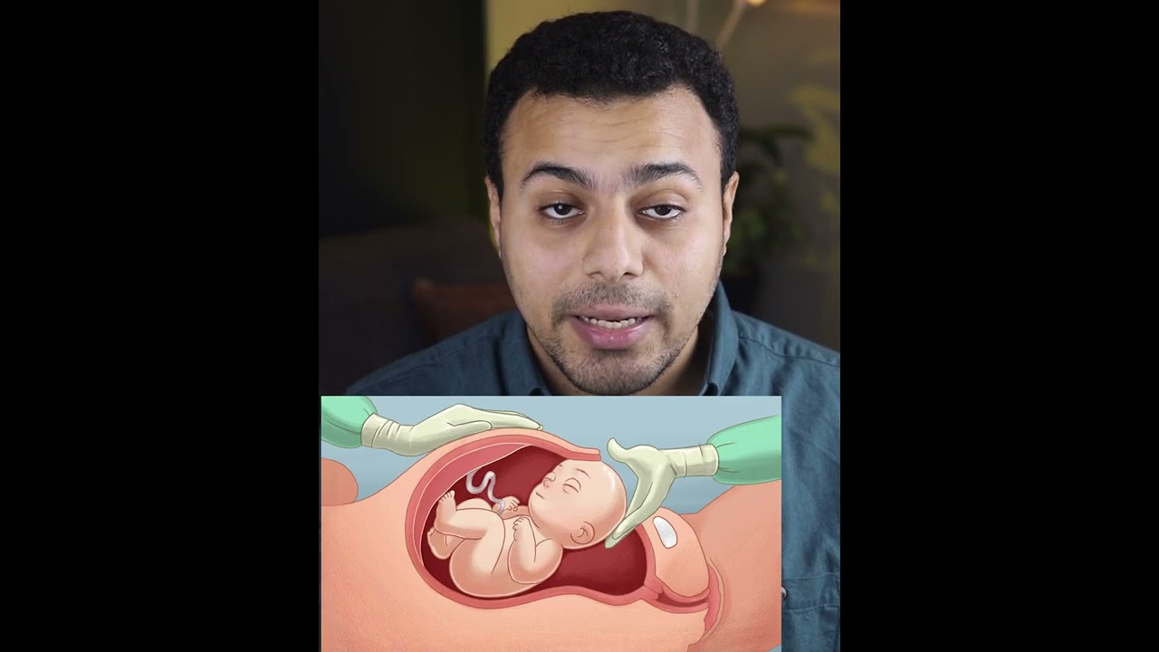 القيصرية داخل غرفة العمليات