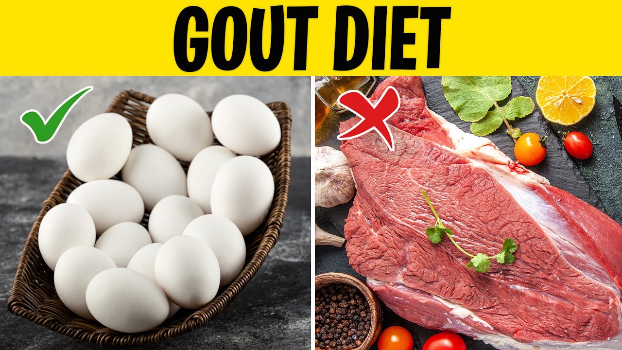 Can You Eat Eggs With Gout