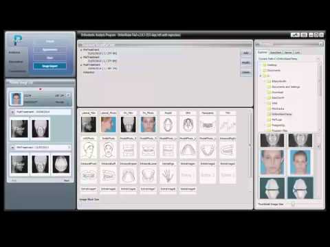 01  Basic Introductory Instructional Tutorial Video For OrthoVision