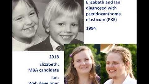 PXE Regional Meeting Webinar 2018 -- Sharon Terry, 9/6/2018