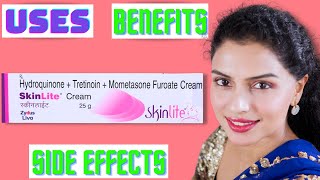 Skinlite Cream Review Zydus Skinlite Cream Side Effects And Benefits Skinlight Cream Ke Fayde