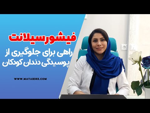 تصویری: ماندگاری سیلانت روی خودرو چقدر است؟