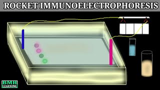 Rocket Immunoelectrophoresis Immunoelectrophoresis 