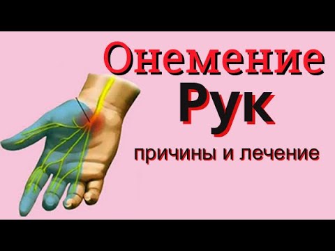 Онемение рук – причины, симптомы и лечение