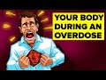 Overdose Risks & What to Do ๐