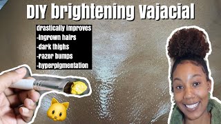 At Home Vajacial Get Rid Of Ingrown Hairs, Hyperpigmentation, Textured Skin & Razor Bumps Fast