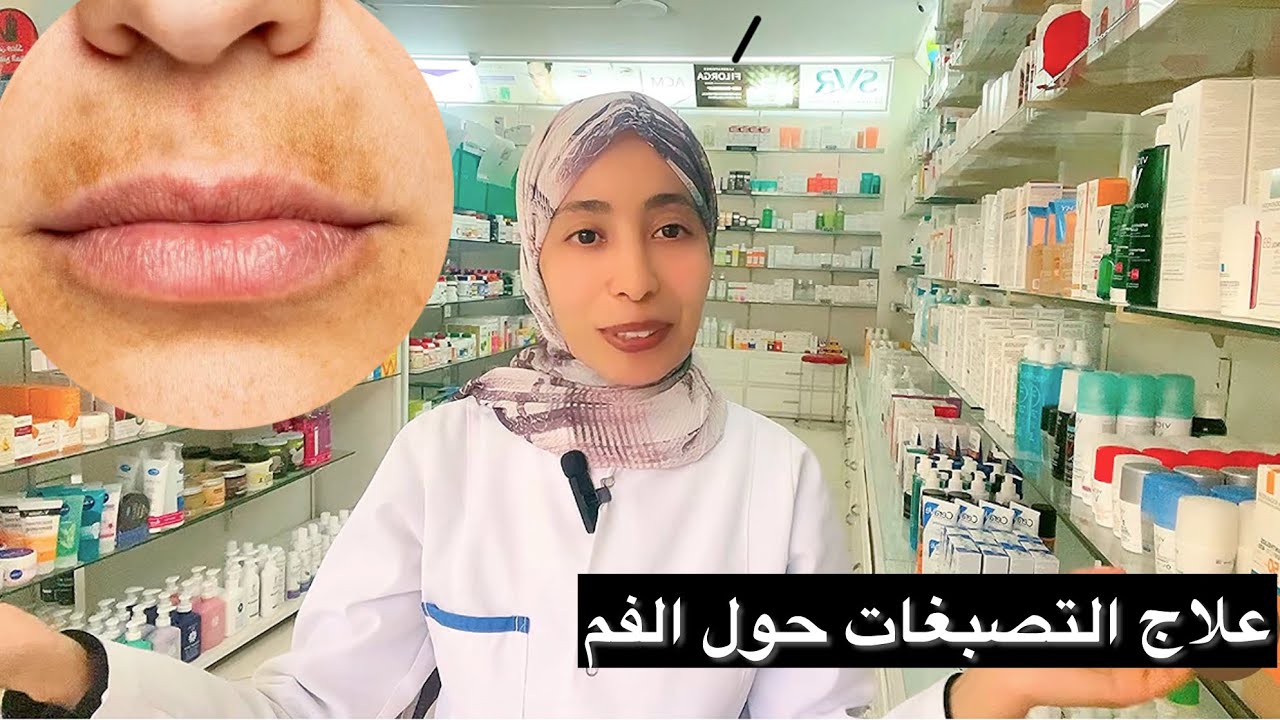تصبغات محيط الفم 👄:أسبابه،الوقاية و العلاج