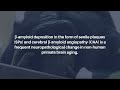 Brain Aging and Alzheimer’s: Insights from Non-Human Primates | Aging-US