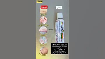 المشاكل وحلولها مهم جدا 