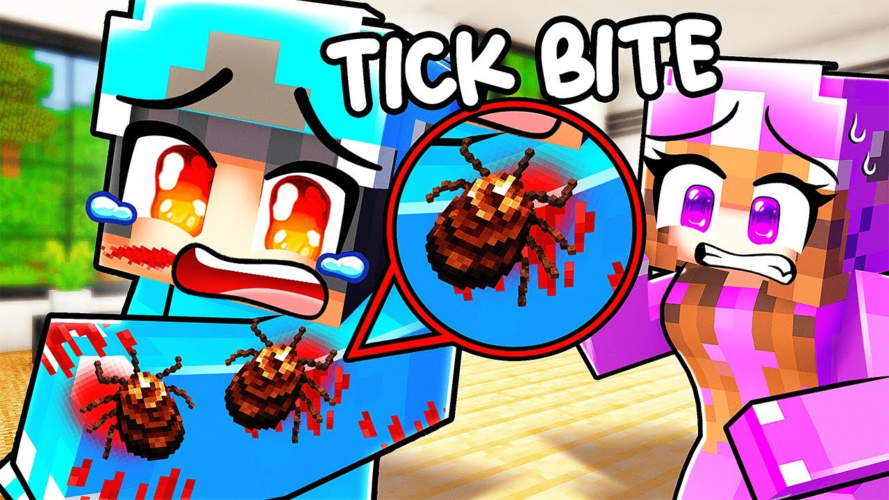 Omz Has TICK BITES...
