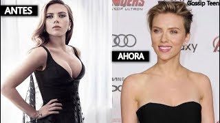 Did Scarlett Johansson get a breast reduction? 😔
