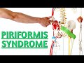 Sciatica Pain May NEVER Improve If You Don't Do 3 Simple Tests For Piriformis Syndrome