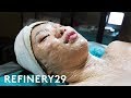 I Tried This Terrifying Facial | Beauty With Mi | Refinery29