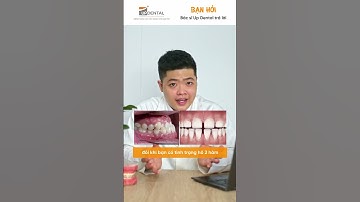 [BẠN HỎI, BÁC SĨ UP DENTAL TRẢ LỜI] - Những trường hợp nào cần niềng răng?